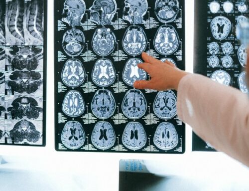 Aligned Radiology Partners with InsiteOne, NewVue.AI, and RADPAIR to Transform Imaging Workflows