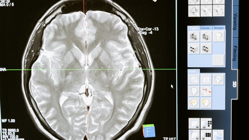 Radiology brain scan