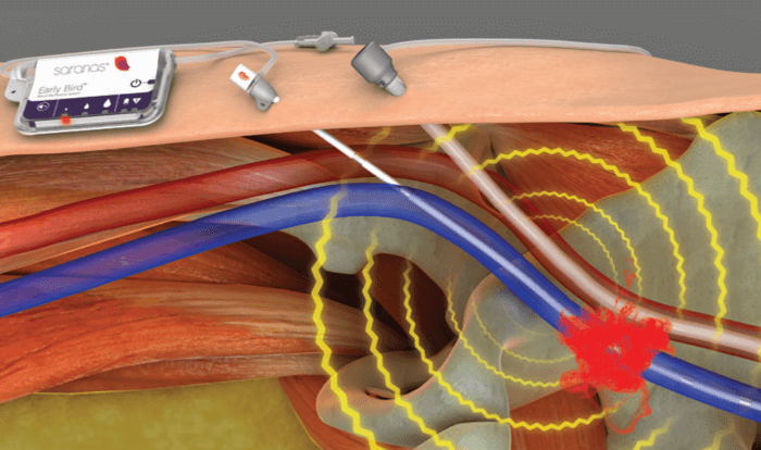 Medical Device