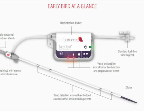 Saranas Secures Patent on Bleed Monitoring Technology