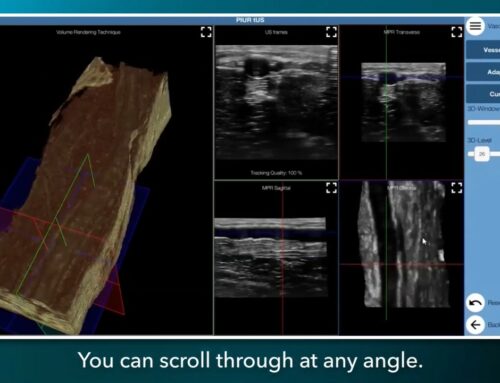 FUJIFILM VisualSonics and PIUR IMAGING Partner on 3D Ultrasound Imaging Technology