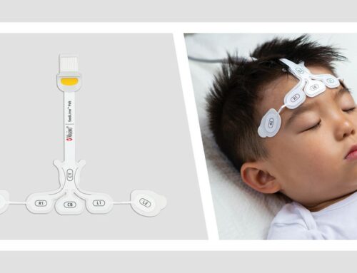 Study Finds Masimo SedLine Brain Function Monitoring Can Help Guide Anesthesia in Children