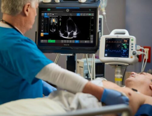 GE Healthcare Adds AI-Driven Caption Guidance to Venue Ultrasound Systems