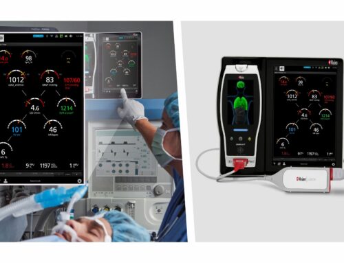 Masimo Gains CE Mark for LiDCO Module, Enhancing Patient Monitoring Capabilities