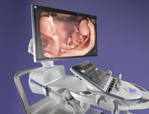 GE HealthCare Launches Voluson Expert Series Ultrasound Systems for Women’s Health