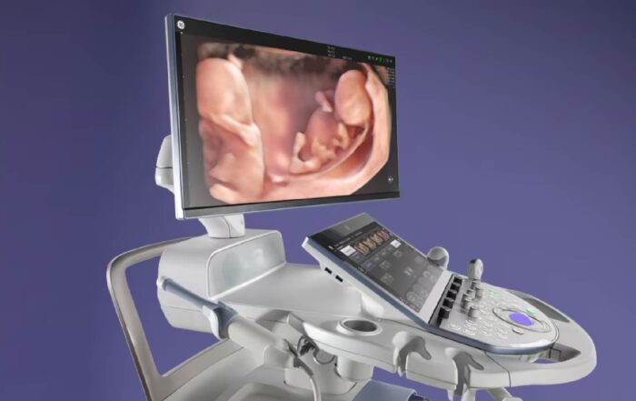 GE ultrasound system with images of a fetus displayed