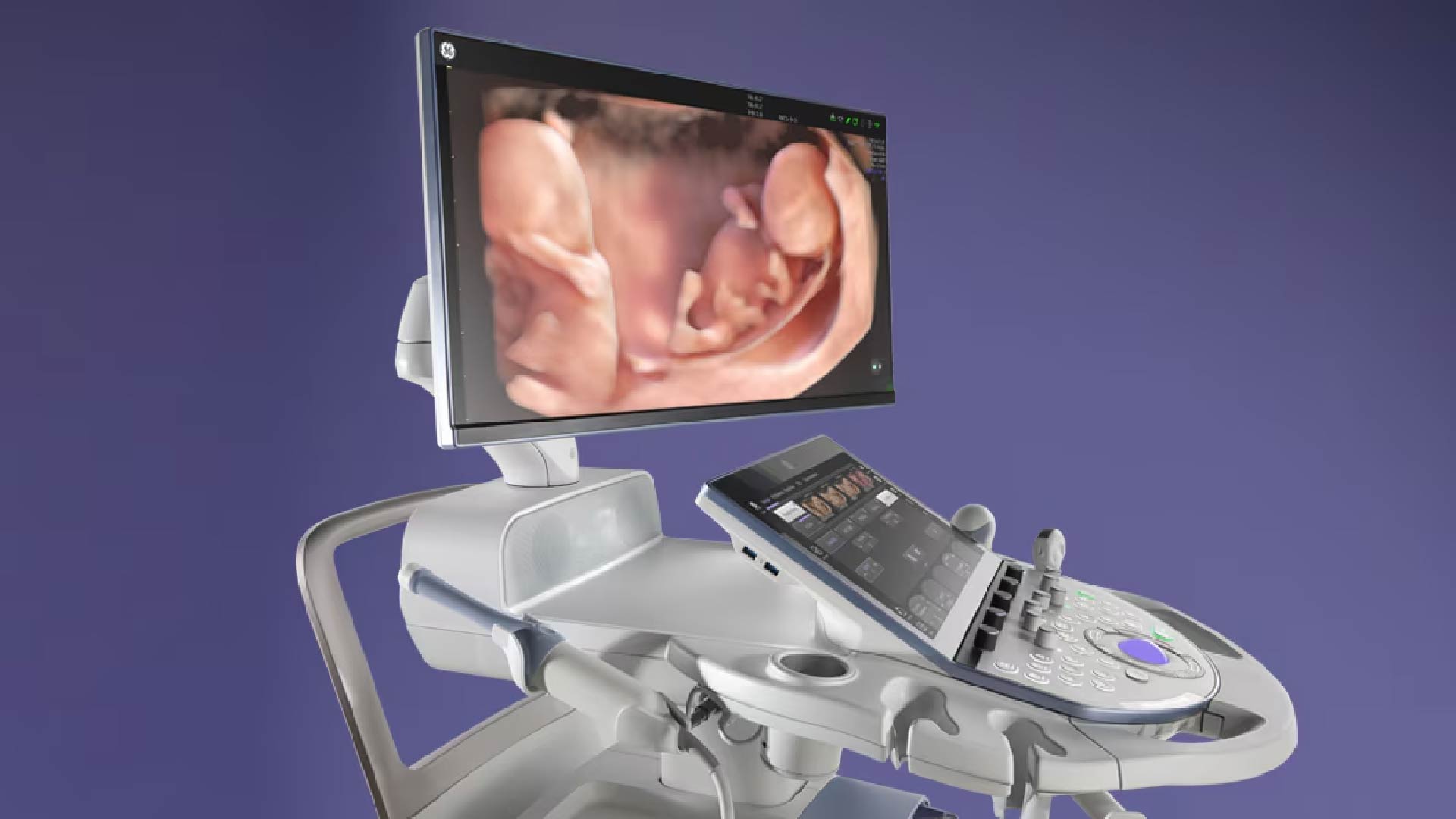 GE ultrasound system with images of a fetus displayed