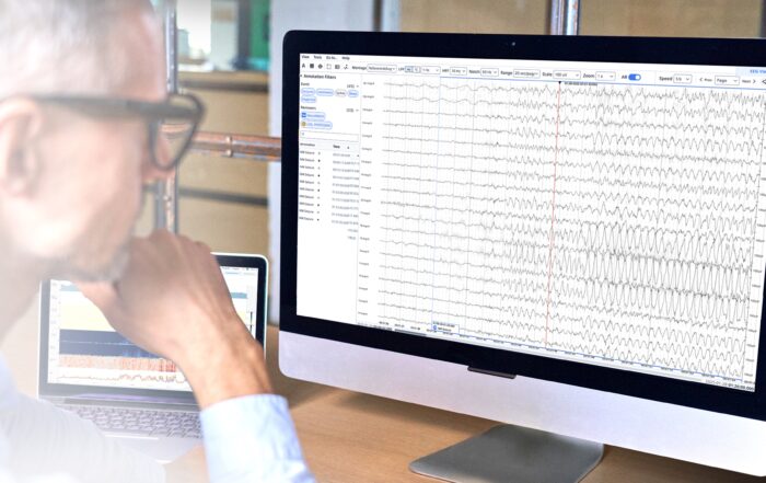 Man looking at computer screen that is displaying EEG signals