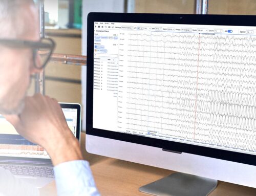 AI-Powered NeuroMatch Pro Enhances EEG Diagnostics with Seizure and Spike Detection